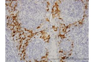 Immunoperoxidase of monoclonal antibody to GSTA3 on formalin-fixed paraffin-embedded human tonsil. (GSTA3 antibody  (AA 1-222))