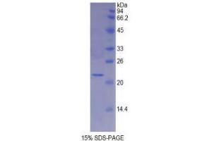 SDS-PAGE analysis of Human MYL4 Protein. (MYL4 Protein)