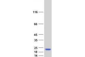 Validation with Western Blot (TRAPPC3 Protein (Myc-DYKDDDDK Tag))