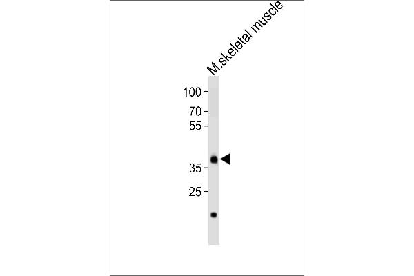 DBX1 antibody  (C-Term)