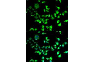 Immunofluorescence analysis of U20S cell using SMC1A antibody. (SMC1A antibody)