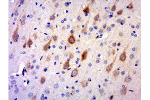 Paraformaldehyde-fixed, paraffin embedded rat brain tissue, Antigen retrieval by boiling in sodium citrate buffer(pH6) for 15min, Block endogenous peroxidase by 3% hydrogen peroxide for 30 minutes, Blocking buffer (normal goat serum) at 37°C for 20min, Antibody incubation with Rabbit Anti-RNF150 Polyclonal Antibody, Unconjugated  at 1:400 overnight at 4°C, followed by a conjugated secondary and DAB staining (RNF150 antibody)