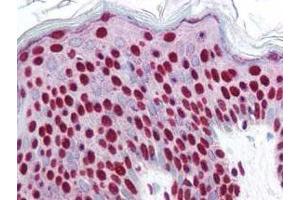Immunohistochemistry (IHC) image for anti-SMAD, Mothers Against DPP Homolog 3 (SMAD3) (pSer423), (pSer425) antibody (ABIN129675)