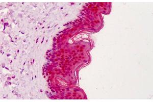 Human Skin: Formalin-Fixed, Paraffin-Embedded (FFPE) (APEX1 antibody)