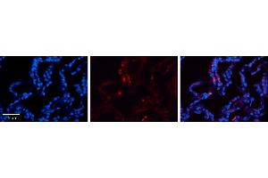 Rabbit Anti-CRIP2 Antibody     Formalin Fixed Paraffin Embedded Tissue: Human Lung Tissue  Observed Staining: Cytoplasmic in alveolar type I cells  Primary Antibody Concentration: 1:100  Other Working Concentrations: 1/600  Secondary Antibody: Donkey anti-Rabbit-Cy3  Secondary Antibody Concentration: 1:200  Magnification: 20X  Exposure Time: 0.