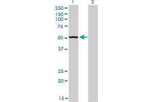 Western Blot analysis of BFAR expression in transfected 293T cell line by BFAR monoclonal antibody (M01), clone 1C6. (BFAR antibody  (AA 101-200))