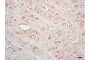 Formalin-fixed and paraffin embedded rat brain labeled with Rabbit Anti ARTS Polyclonal Antibody, Unconjugated (ABIN872659) at 1:200 followed by conjugation to the secondary antibody and DAB staining (Septin 4 antibody  (AA 91-150))