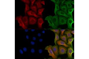 ABIN6264594 and ABIN6279749 staining Hela cells by IF/ICC.