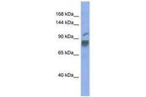 Image no. 1 for anti-Heterogeneous Nuclear Ribonucleoprotein U-Like 1 (HNRNPUL1) (AA 467-516) antibody (ABIN6743001) (HNRNPUL1 antibody  (AA 467-516))