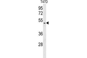 Western Blotting (WB) image for anti-BRISC and BRCA1 A Complex Member 1 (BABAM1) antibody (ABIN3003809)