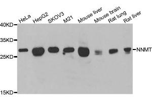 Western blot analysis of extracts of various cell lines, using NNMT antibody (ABIN5974021) at 1/1000 dilution.