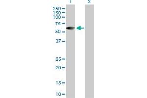 Western Blot analysis of HSFX1 expression in transfected 293T cell line by HSFX1 MaxPab polyclonal antibody. (HSFX1 antibody  (AA 1-423))