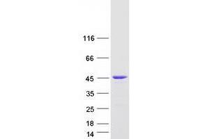 Discs, Large (Drosophila) Homolog-Associated Protein 4 (DLGAP4) (Transcript Variant 3) protein (Myc-DYKDDDDK Tag)