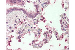 Human, Lung: Formalin-Fixed Paraffin-Embedded (FFPE). (MZF1 antibody  (N-Term))