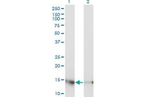 Western Blot analysis of UBE2D3 expression in transfected 293T cell line by UBE2D3 monoclonal antibody (M01), clone 4C1-1E3. (UBE2D3 antibody  (AA 1-147))