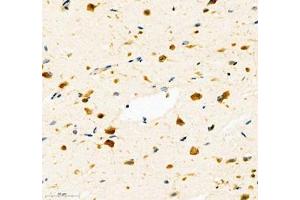 Immunohistochemistry of paraffin embedded human brain using NACAD (ABIN7074756) at dilution of 1:700 (300x lens)