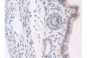 Immunohistochemistry (IHC) image for anti-Nucleophosmin (Nucleolar phosphoprotein B23, Numatrin) (NPM1) (AA 212-292) antibody (ABIN7438103)