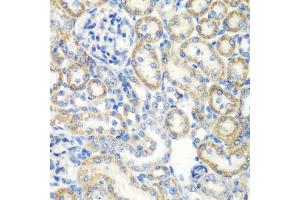 Immunohistochemistry of paraffin-embedded rat kidney using SMYD1 antibody (ABIN6128707, ABIN6148163, ABIN6148165 and ABIN6219496) at dilution of 1:200 (40x lens). (SMYD1 antibody  (AA 1-350))