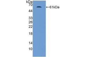 Western blot analysis of recombinant Human MR. (NR3C2 antibody  (AA 739-984))