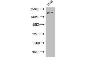 Western Blot Positive WB detected in: Mouse lung tissue All lanes: TSC2 antibody at 2. (Tuberin antibody  (AA 1396-1496))