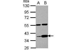 WB Image Sample (30 ug of whole cell lysate) A: PC-3 B: U87-MG 10% SDS PAGE antibody diluted at 1:1000