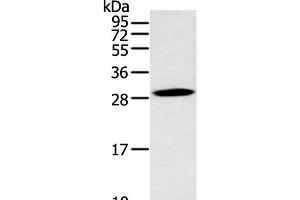 Western blot analysis of Mouse stomach tissue using YRDC Polyclonal Antibody at dilution of 1:400 (YRDC antibody)