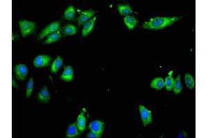 Immunofluorescent analysis of Hela cells using ABIN7143077 at dilution of 1:100 and Alexa Fluor 488-congugated AffiniPure Goat Anti-Rabbit IgG(H+L) (ARPC1A antibody  (AA 175-317))