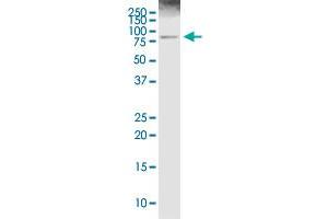 ALOX5 MaxPab rabbit polyclonal antibody. (ALOX5 antibody  (AA 1-674))