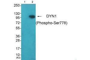 Western blot analysis of extracts from HepG2 cells (Lane 2), using DYN1 (Phospho-Ser778) Antibody. (Dynamin 1 antibody  (pSer778))