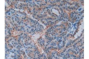 Used in DAB staining on fromalin fixed paraffin- embedded liver tissue (Annexin A3 antibody  (AA 19-154))