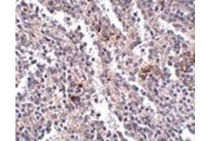 Immunohistochemistry of SYPL2 in human spleen tissue with this product at 2. (SYPL2 antibody  (C-Term))