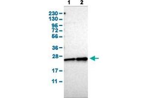 Western Blot analysis of (1) human cell line RT-4, and (2) human cell line U-251MG sp. (CBX5 antibody  (AA 30-137))