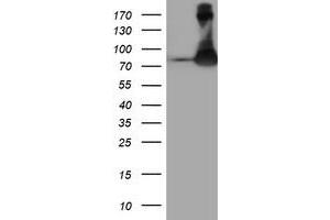 HEK293T cells were transfected with the pCMV6-ENTRY control (Left lane) or pCMV6-ENTRY FBXO21 (Right lane) cDNA for 48 hrs and lysed. (FBXO21 antibody)