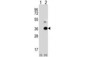 Western blot analysis of ANGPTL7 (arrow) using rabbit polyclonal ANGPTL7 Antibody (C-term) . (ANGPTL7 antibody  (C-Term))