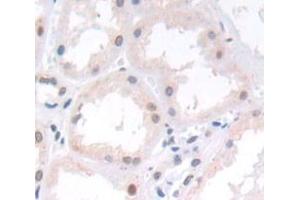 Figure. (PNMA2 antibody  (AA 7-290))