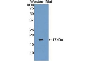 WB of Protein Standard: different control antibodies against Highly purified E. (TGFB3 ELISA Kit)