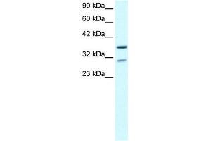 WB Suggested Anti-ZNF385 Antibody Titration:  0. (ZNF385A antibody  (N-Term))