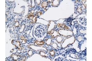 Formalin-fixed and paraffin embedded rat kidney labeled with Anti-CD59 Polyclonal Antibody, Unconjugated (ABIN732338) followed by conjugation to the secondary antibody and DAB staining (CD59 antibody  (AA 52-100))