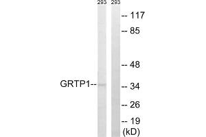 Western blot analysis of extracts from 293 cells, using GRTP1 antibody. (GRTP1 antibody  (Internal Region))
