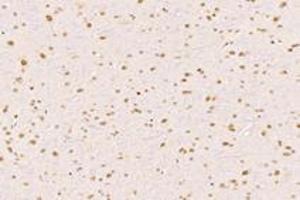 Immunohistochemistry (Paraffin-embedded Sections) (IHC (p)) image for anti-Exportin 7 (XPO7) antibody (ABIN7073901)