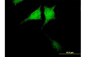 Immunofluorescence of purified MaxPab antibody to CARD8 on HeLa cell. (CARD8 antibody  (AA 1-392))