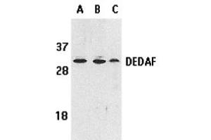 Western Blotting (WB) image for anti-RING1 and YY1 Binding Protein (RYBP) antibody (ABIN1031706)