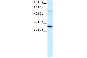 PARP1 antibody used at 5 ug/ml to detect target protein. (PARP1 antibody)
