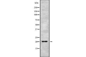 Western blot analysis of MED28 using MCF7 whole cell lysates (MED28 antibody  (Internal Region))