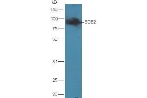 Mouse brain lysates probed with Rabbit Anti-ECE2 Polyclonal Antibody, Unconjugated (ABIN733958) at 1:300 overnight at 4 °C. (ECE2 antibody  (AA 601-700))