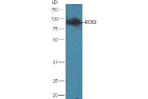 ECE2 antibody  (AA 601-700)