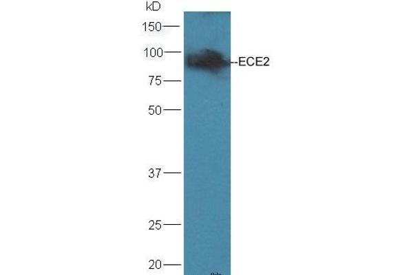 ECE2 抗体  (AA 601-700)