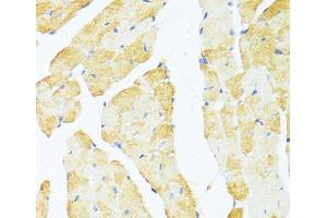 Immunohistochemistry of paraffin-embedded Mouse heart using DDX3Y Polyclonal Antibody at dilution of 1:100 (40x lens). (DDX3Y antibody)