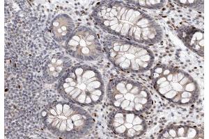 Immunohistochemistry (IHC) image for anti-C-Abl Oncogene 1, Non-Receptor tyrosine Kinase (ABL1) (pTyr393), (pTyr412) antibody (ABIN6256727)