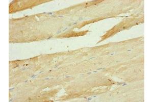 Immunohistochemistry of paraffin-embedded human skeletal muscle tissue using ABIN7149113 at dilution of 1:100 (UQCRC1 antibody  (AA 1-63))